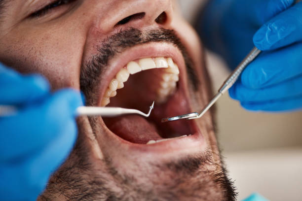 Best Urgent Care for Lost Fillings or Crowns in Gainesville, TX