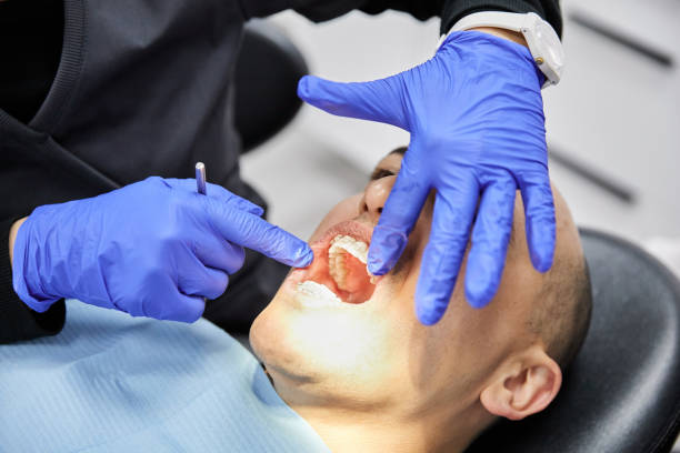 Best Emergency Root Canal Treatment in Gainesville, TX