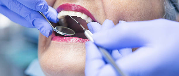 Best Emergency Gum Treatment in Gainesville, TX